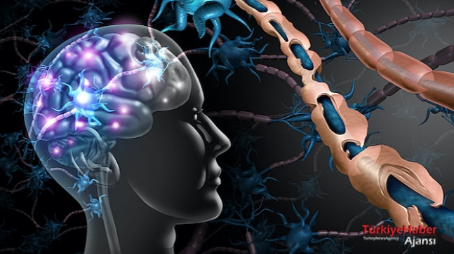 Multiple Skleroz (MS) Hastalığı Nedir Ve Tedavisi Nasıldır?  – Sağlık