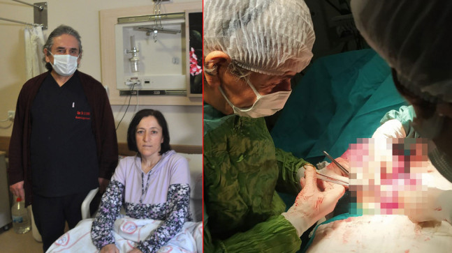 Tam 40 santimetre boyunda! Kilo aldığını sanıyordu, karnından çıkanlar görenleri şaşırttı