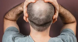 Kel olan erkekler dikkat – Sağlık Haberleri