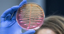 “Klebsiella pneumoniae” bakterisi antibiyotiklere karşı direnç kazanacak