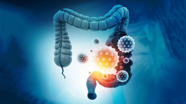 4 belirti, erken evre kolon kanseri riskinin yüksek olduğunu gösteriyor