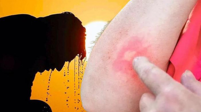 Aman dikkat! Yaz aylarında ortaya çıkıyor, gördüğünüz an kaçın: “Felç olabilirsiniz”